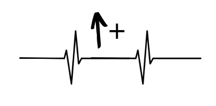 825f6eb0eb9085e81aab0da0d426caec.png
